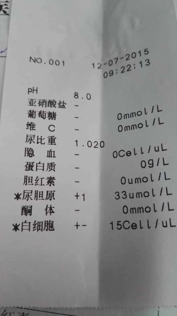 尿液打印结果